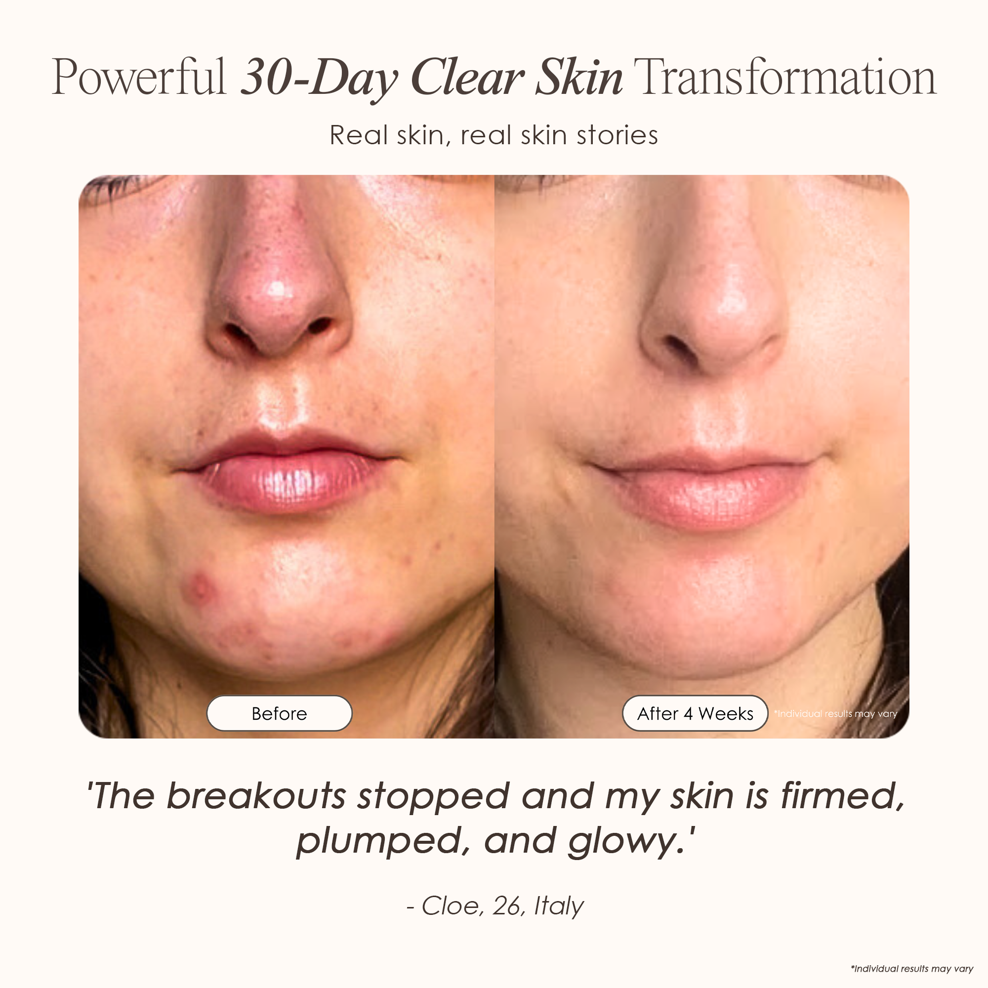 visible results after 30 days of using the High-Frequency Wand